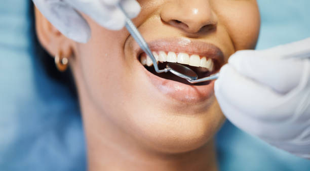 Best Emergency Dental Surgery in Benton City, WA