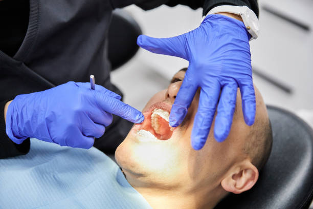 Best Emergency Root Canal Treatment in Benton City, WA