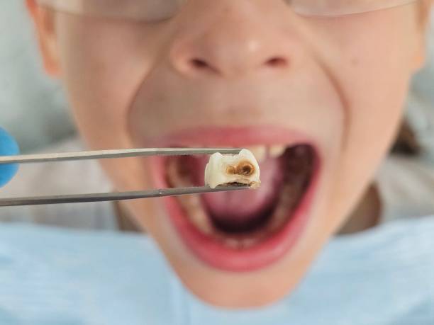 Best Weekend Emergency Dentist in Benton City, WA